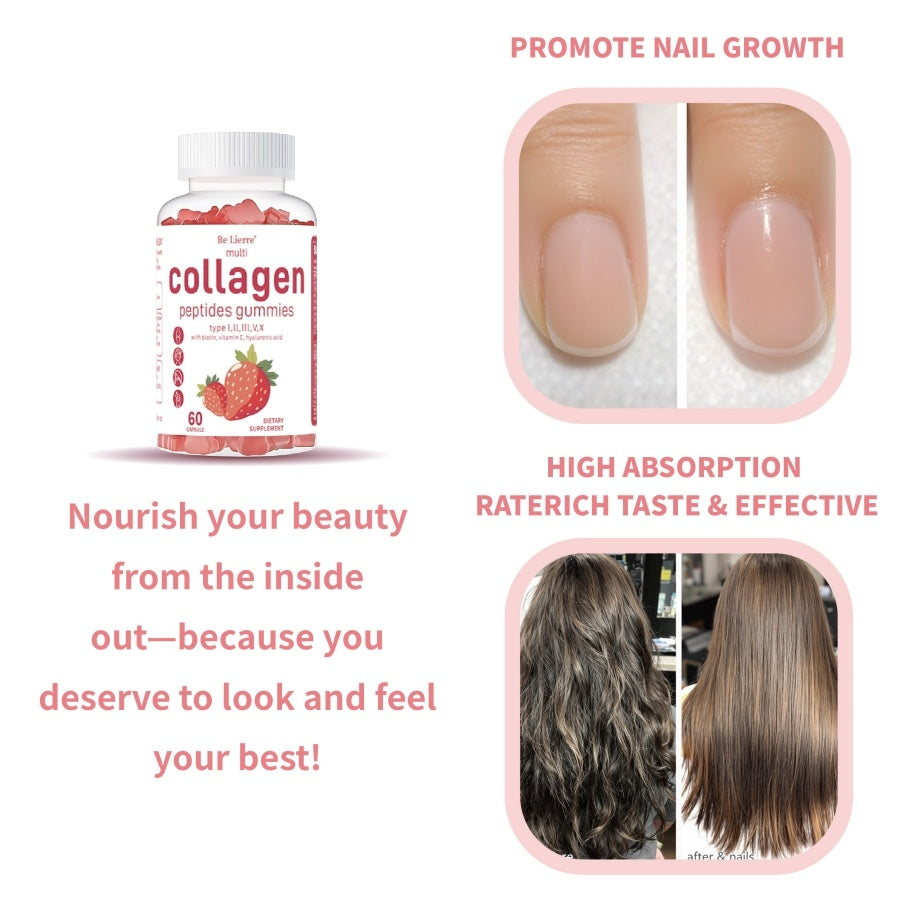 Collagen Peptide Gummies for Hair, Skin & Nails – Hydrolyzed Collagen Supplement with Biotin & Vitamin C